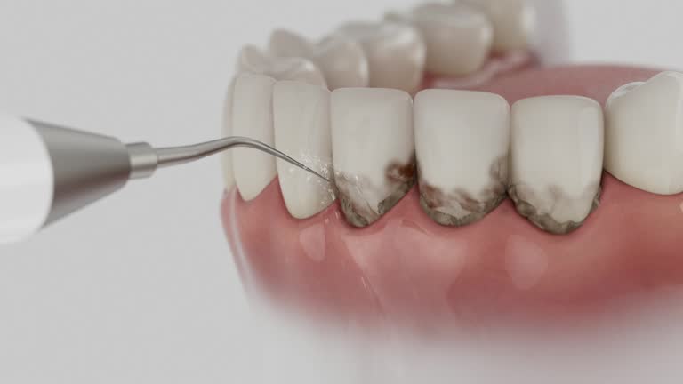 Reliable Tooth Extraction contractor in Forest Heights, TX by Smile Center Dentistry